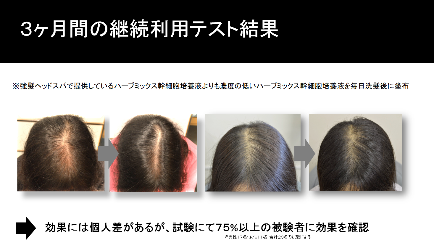話題の強髪ポレーション施術、マツ毛をマツ育のHSCヒト幹細胞培養液 